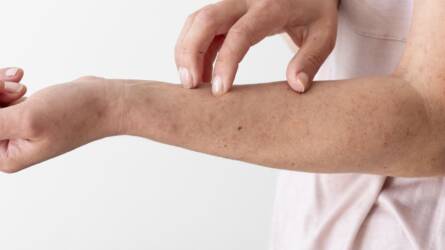 A levegőbe fecskendezett mérge is veszélyes ennek a rovarnak, már Magyarországon is megjelent